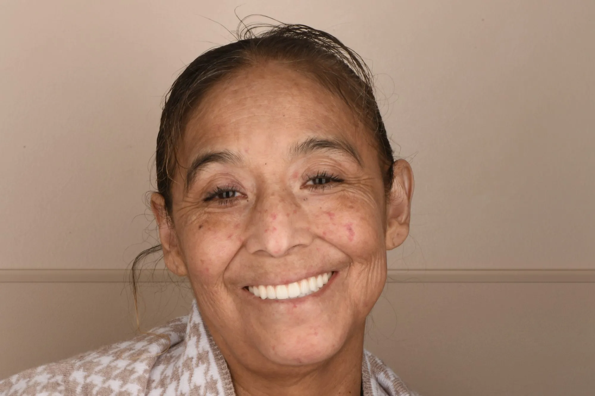 Patient face after treatment
