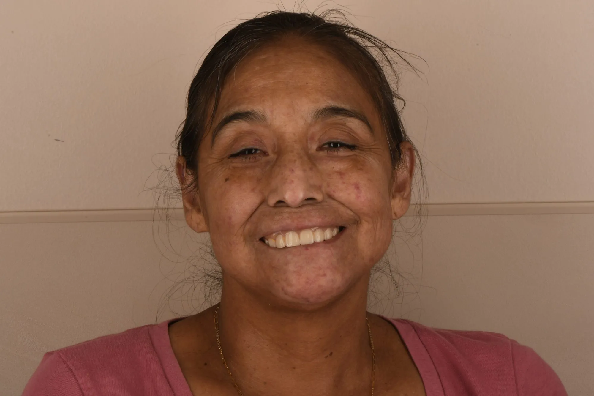 Patient face before treatment