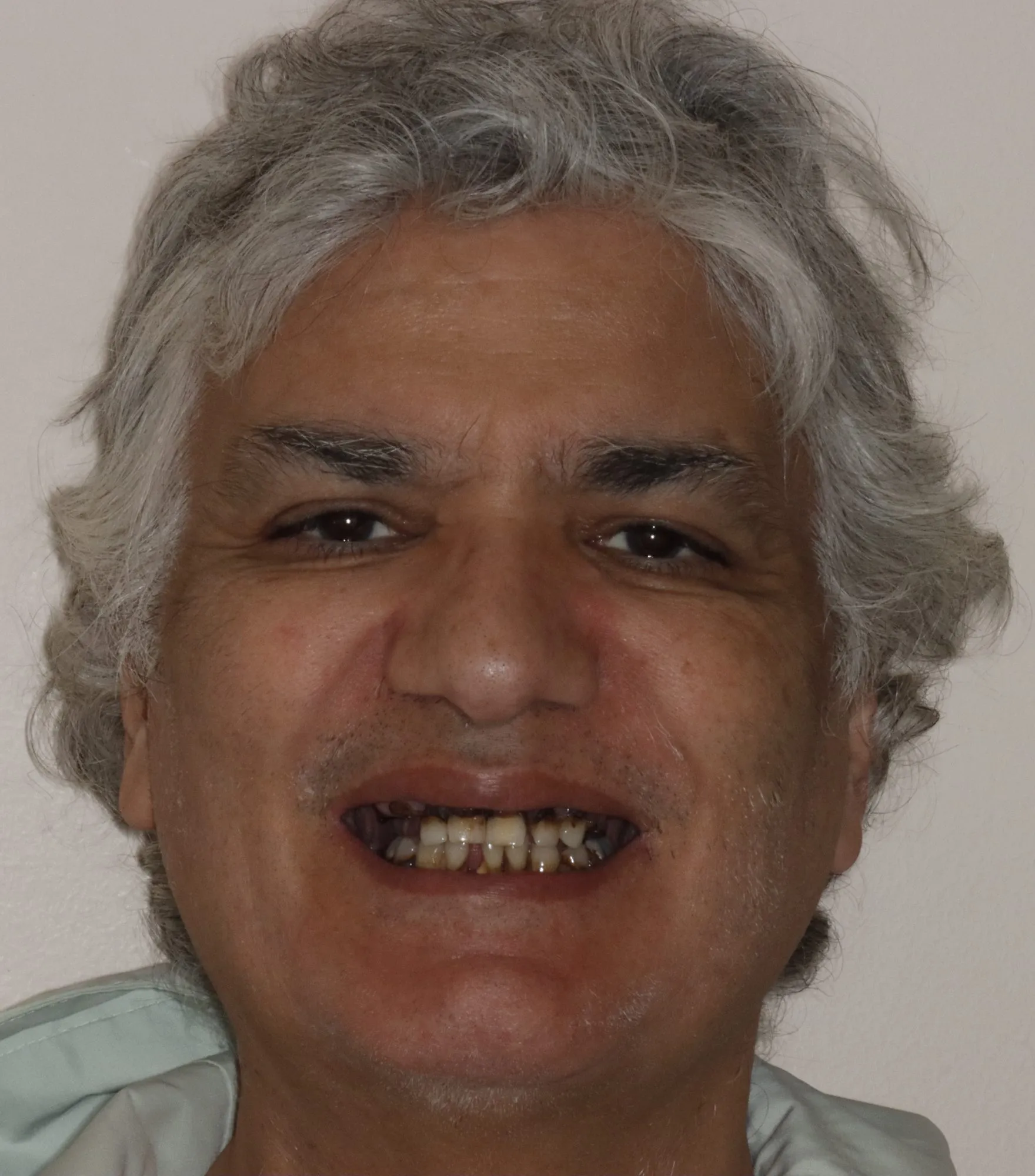 Patient face before treatment