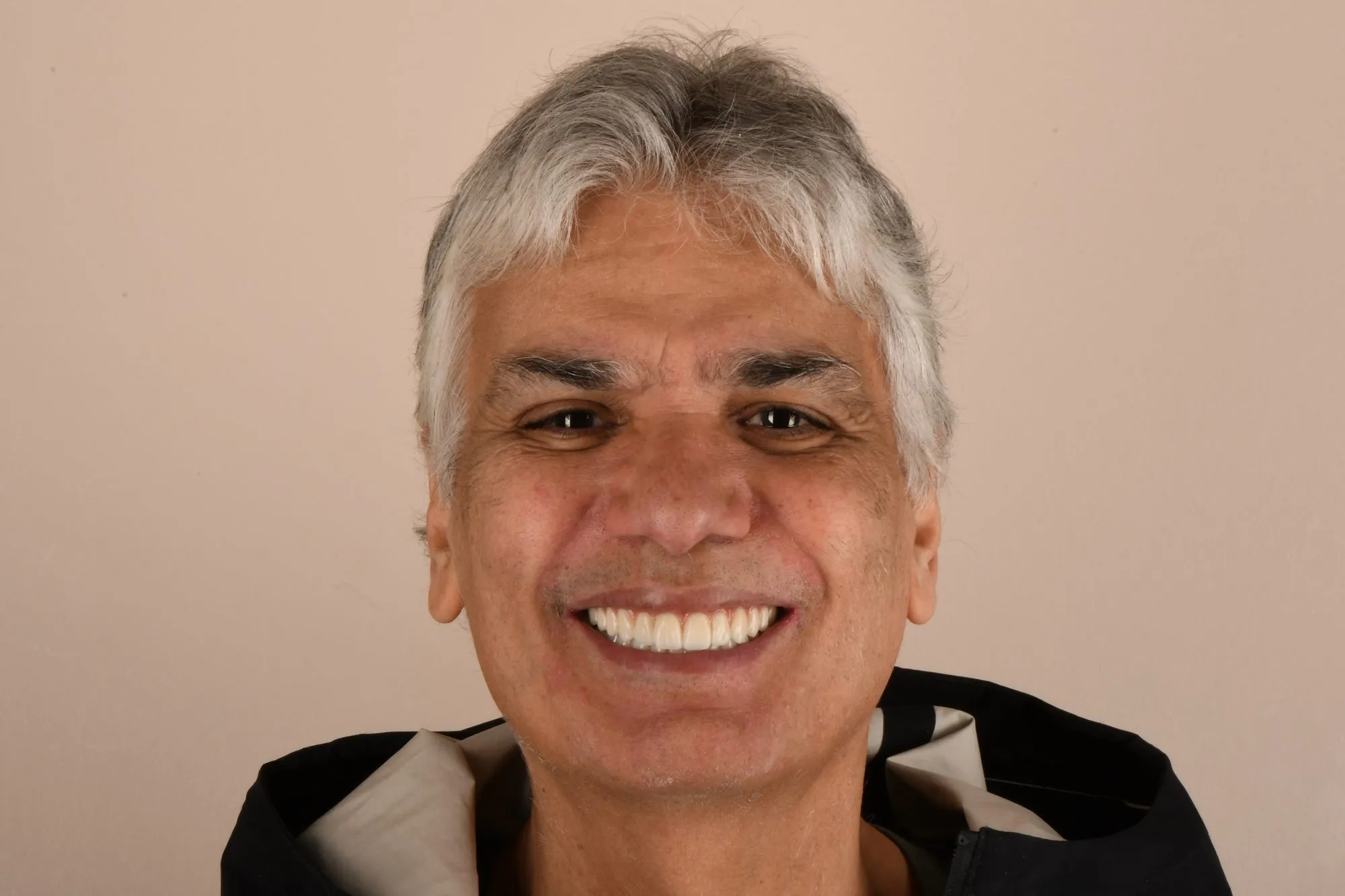 Patient face after treatment