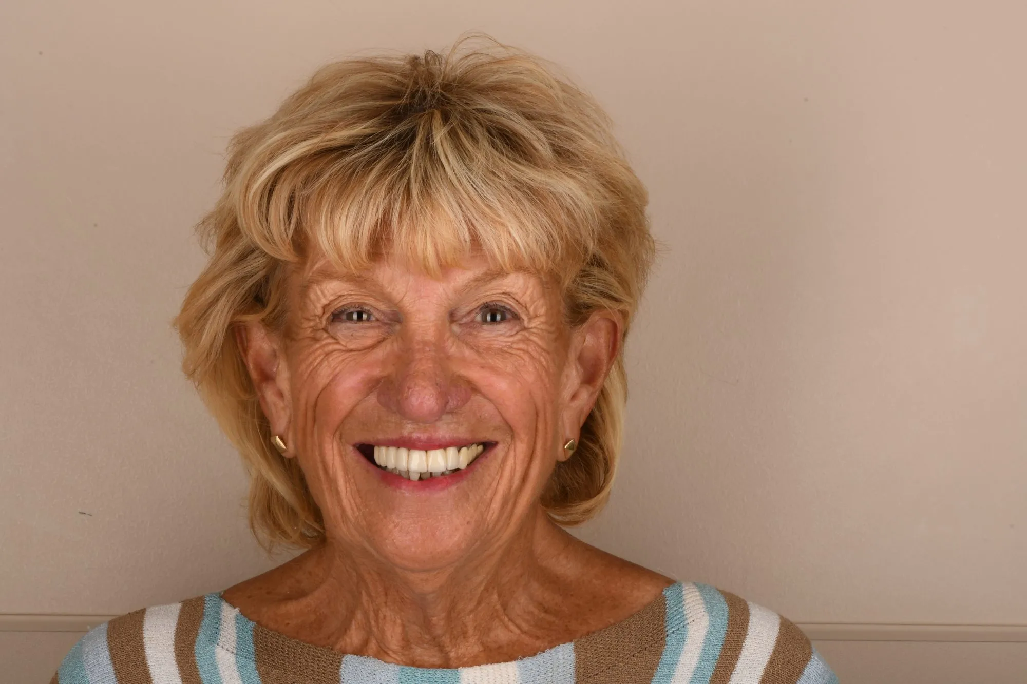 Patient face before treatment