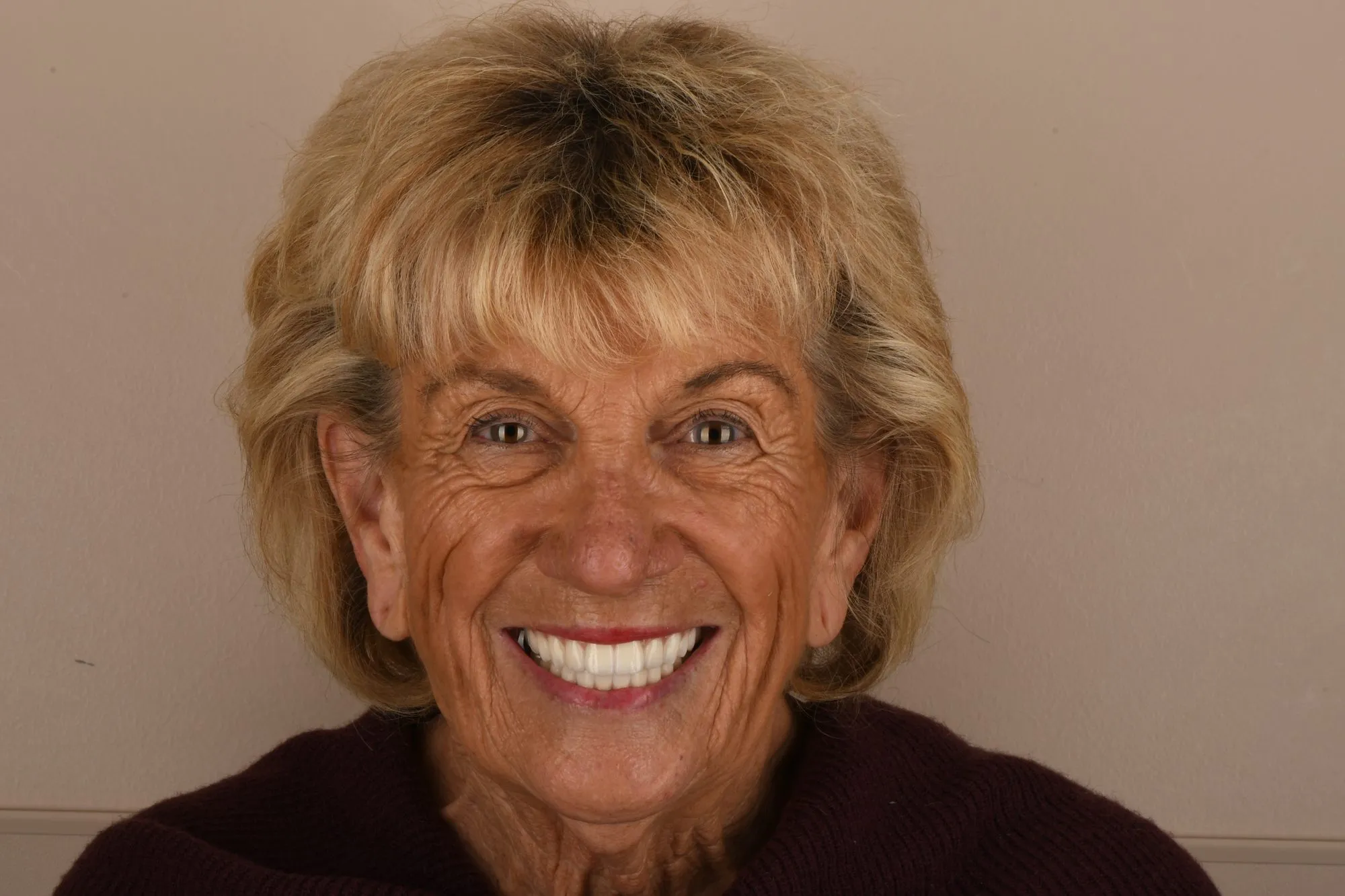 Patient face after treatment