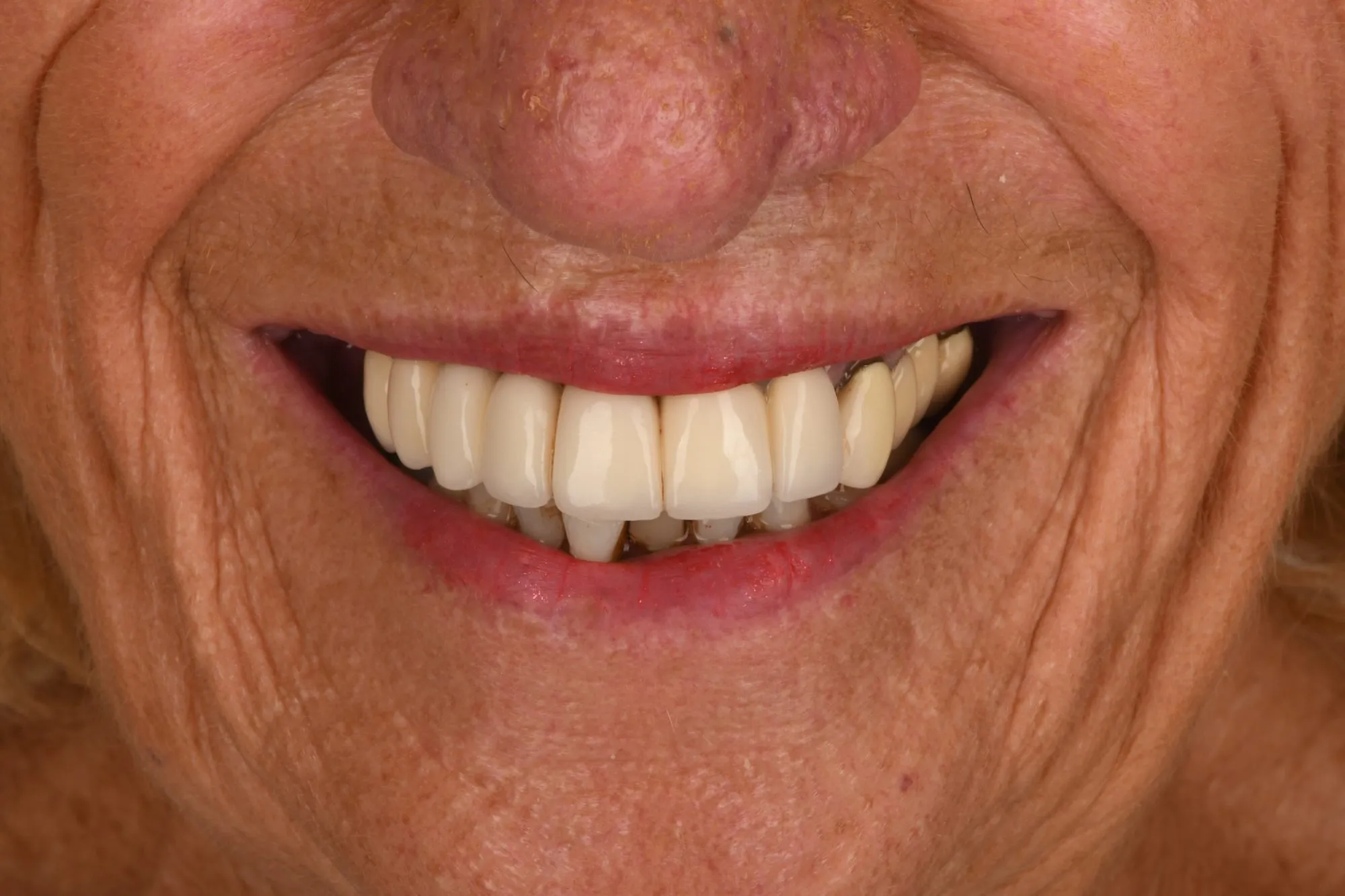 Smile close-up before treatment