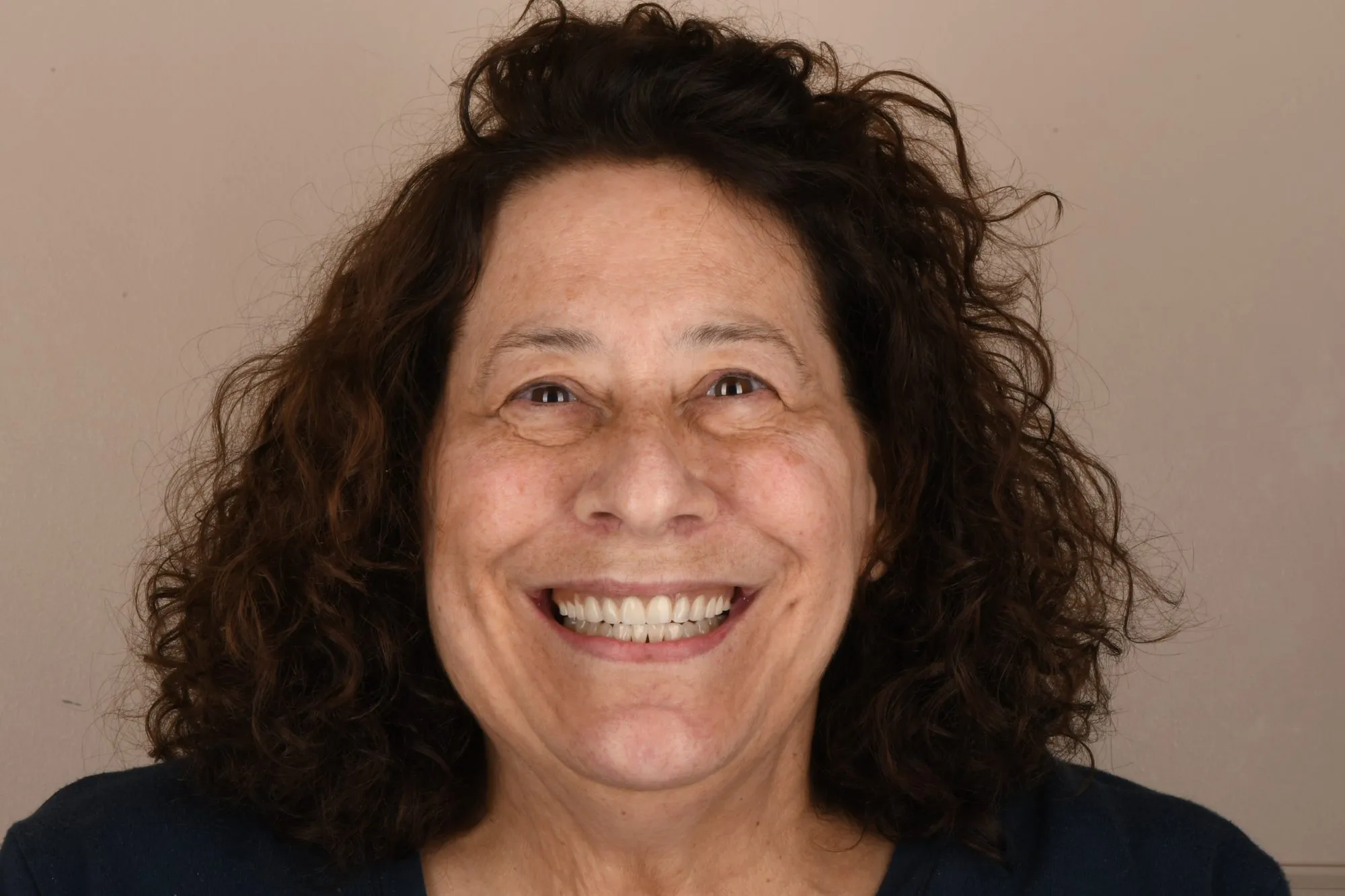 Patient face before treatment