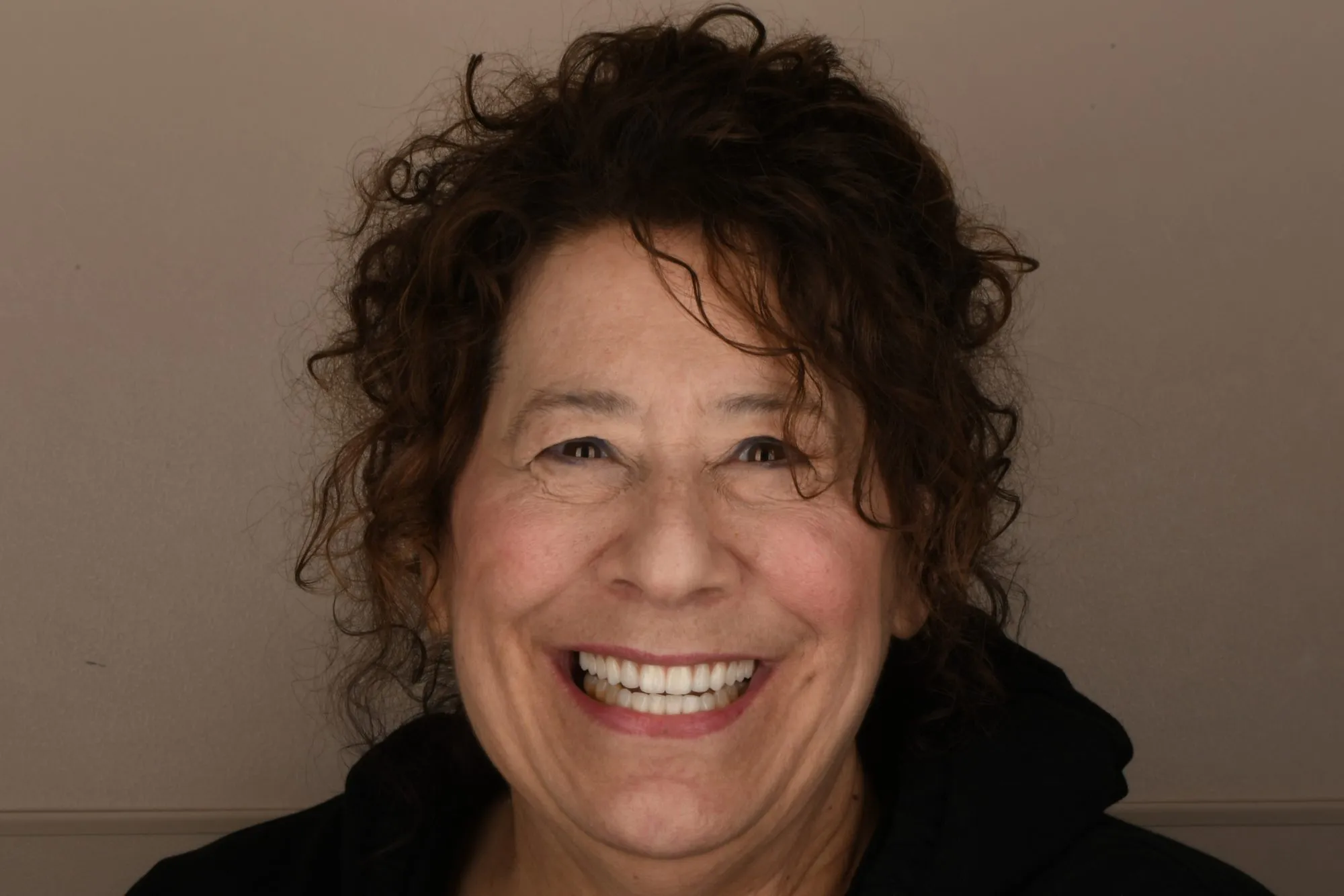 Patient face after treatment