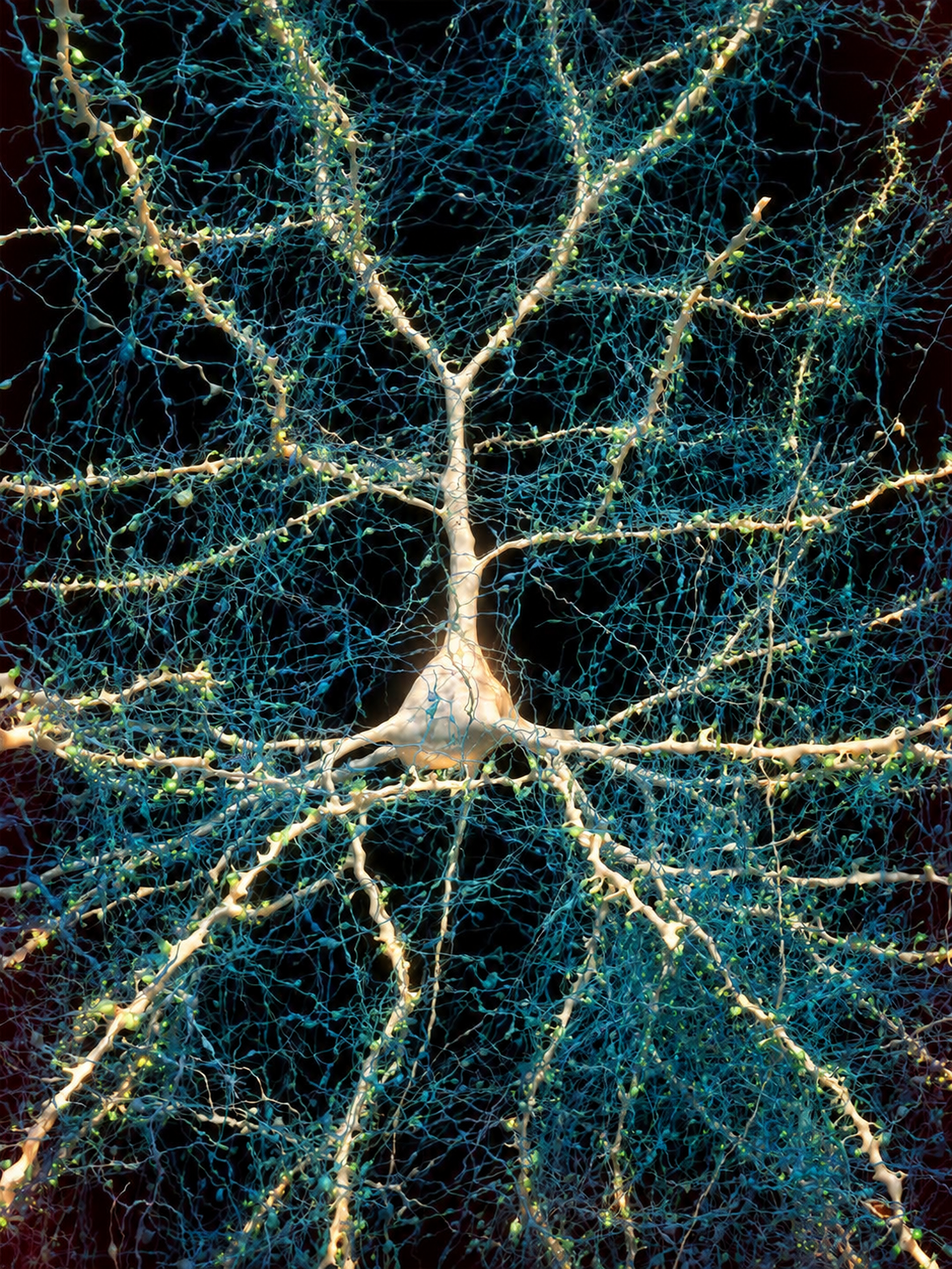 A human neuron surrounded by thousands of connecting nerve fibres