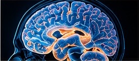 Brain imaging visualization