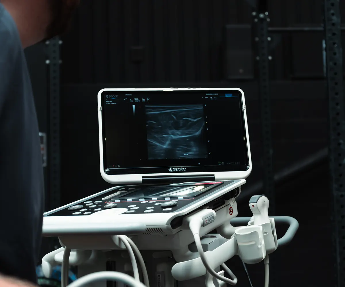 Ultrasound scanner screen showing a live scan