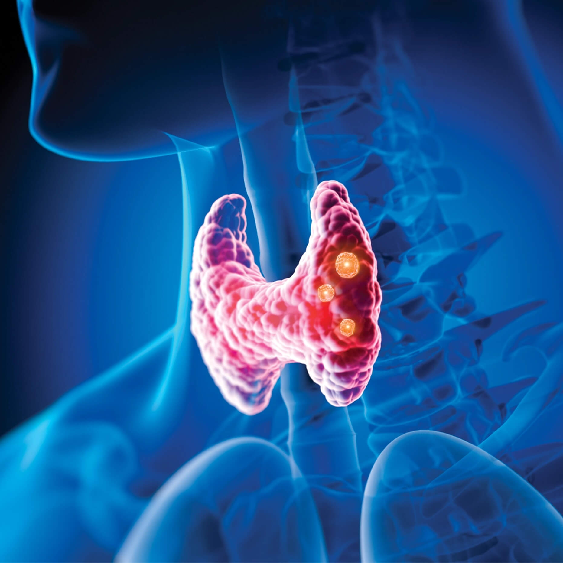 3D rendering of the thyroid gland with highlighted nodules