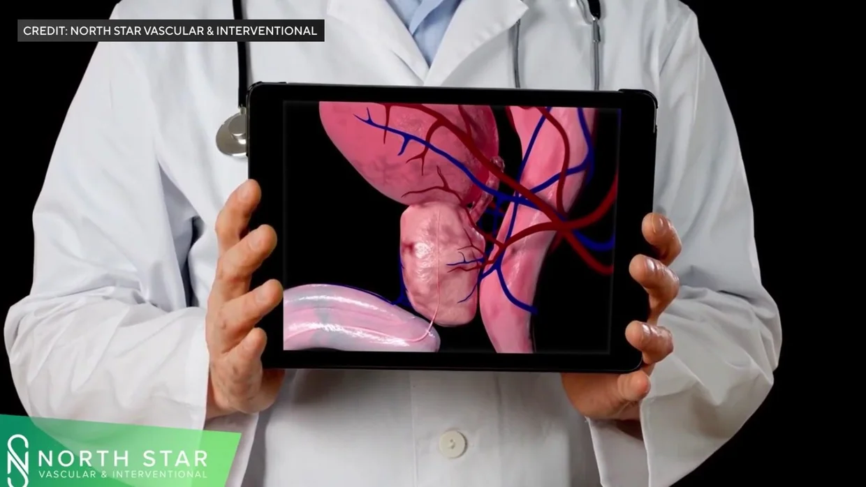 Doctor holding a tablet showing a digital 3D model of the male reproductive system and blood vessels.