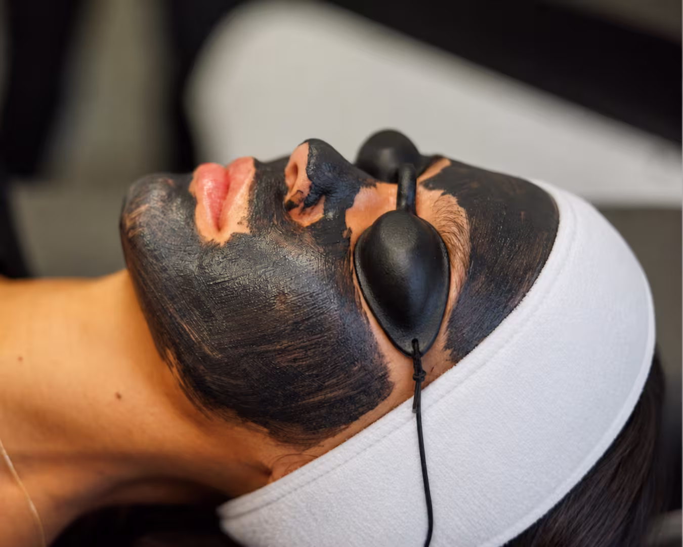 Carbon facial treatment
