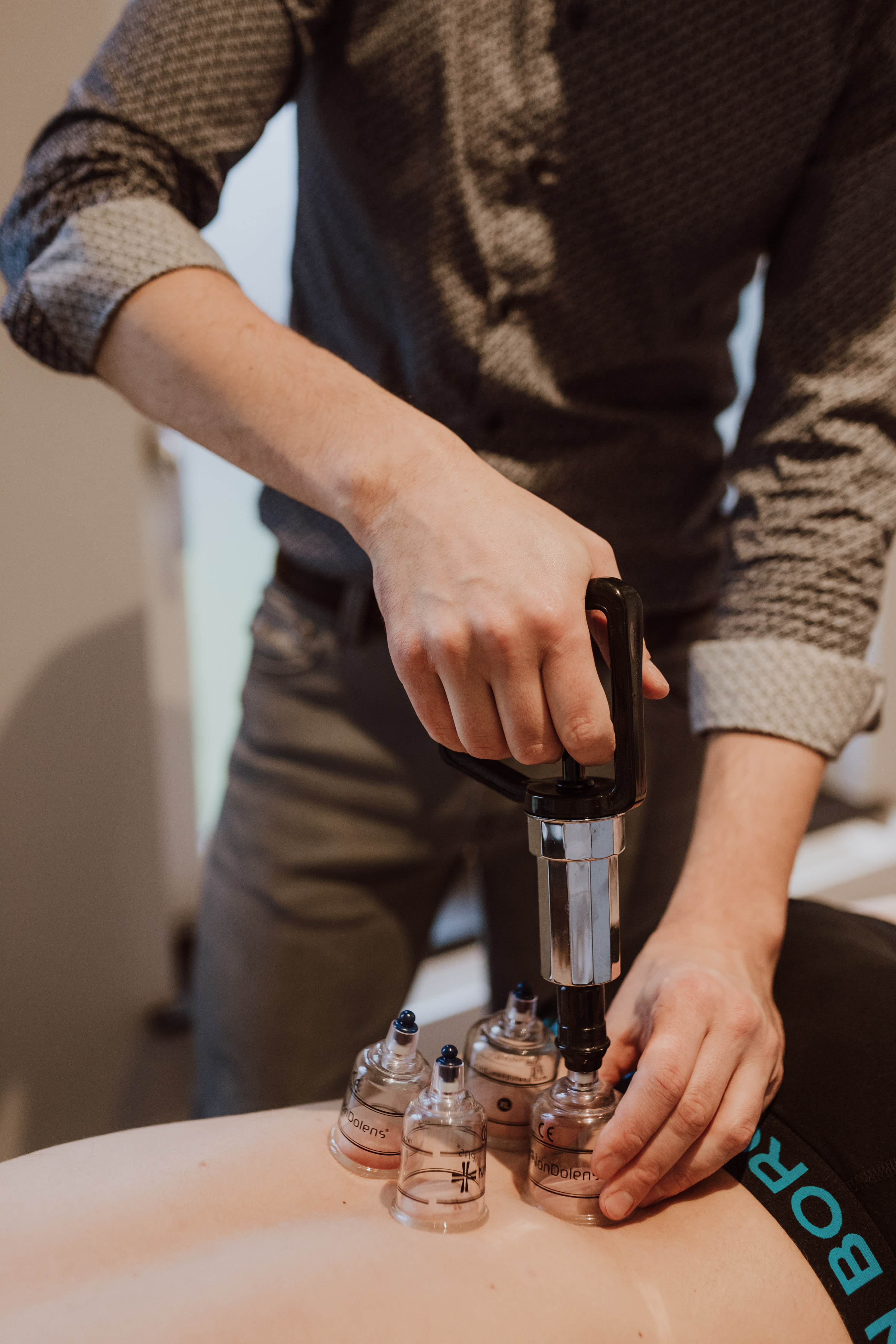 Cupping met vacuümpomp op de rug