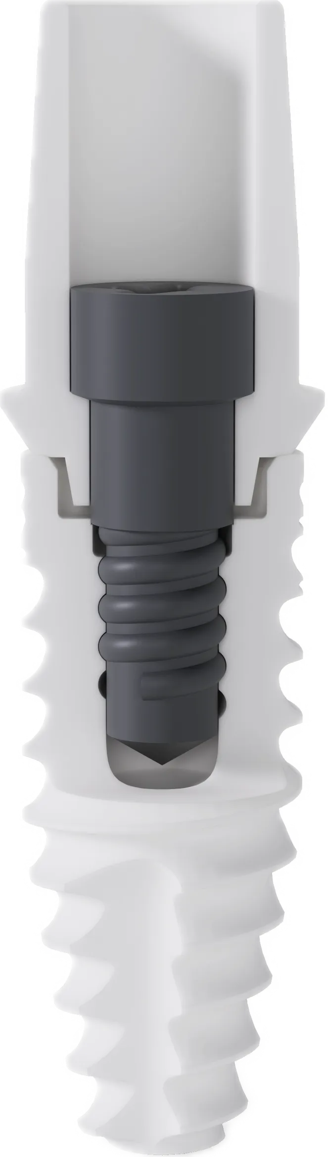 Querschnitt durch ein zweiteiliges Keramikimplantat mit Aufbau und Carbon-Schraube