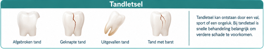 Soorten tandletsel: afgebroken tand, geknapte tand, uitgevallen tand en tand met barst