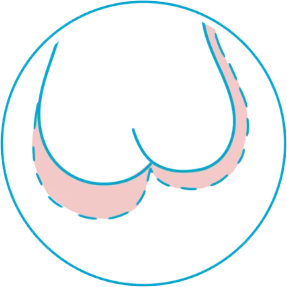 Self-exam step illustration 7