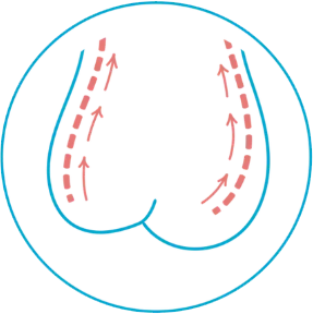 Self-exam step illustration 4