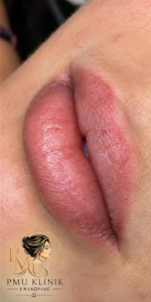Läppar före Lip Blush