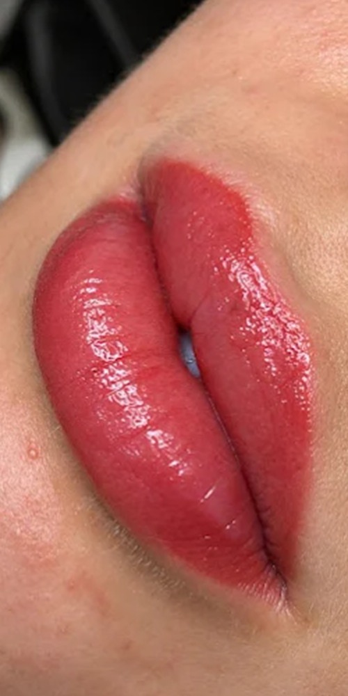 Läppar efter Lip Blush