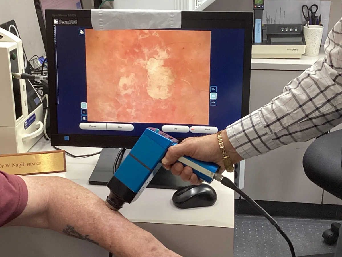 Dr Nagib checking a patient's arm with a hand-held dermatoscope, with the magnified view on screen