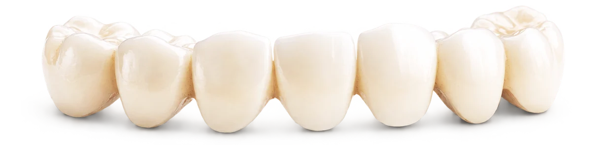 Upper and lower porcelain dental bridges