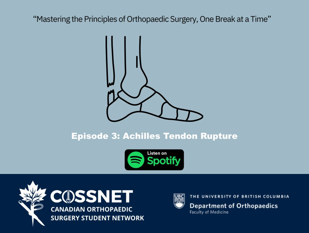 Achilles Tendon Rupture