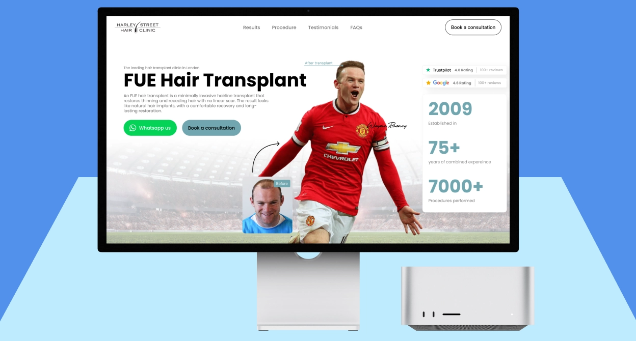 Computer monitor displaying a hair transplant clinic webpage featuring FUE Hair Transplant, a before-and-after photo of a man with restored hair, and a large photo of a football player in a red Manchester United jersey celebrating, identified as Wayne Rooney. The page highlights clinic ratings, established in 2009, 75+ years experience, and 7000+ procedures performed. Buttons for WhatsApp and booking consultations are visible.
