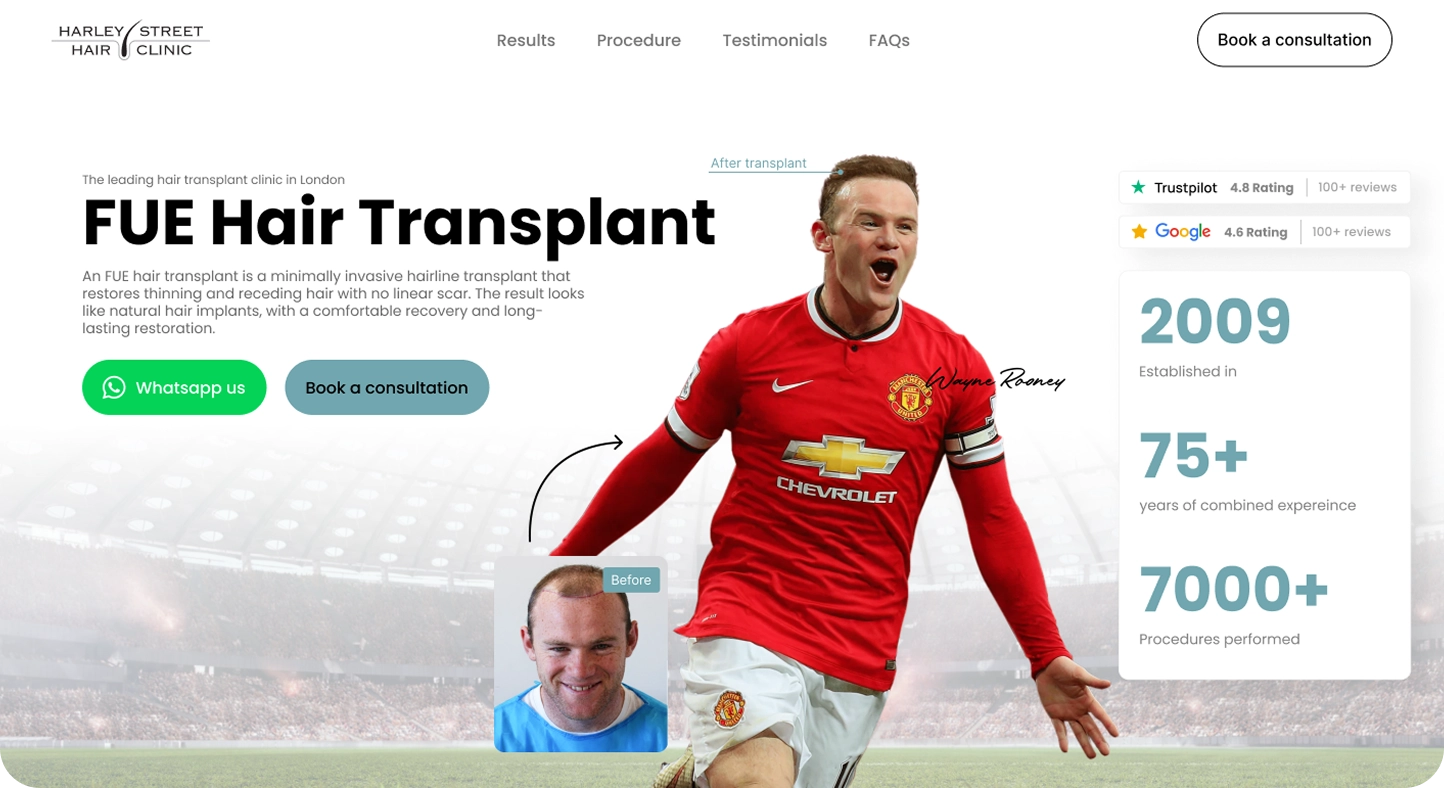 Website header for Harley Street Hair Clinic promoting FUE Hair Transplant with a before and after image of footballer Wayne Rooney, showing hair transplant results, with options to WhatsApp or book a consultation and trust ratings and stats about the clinic.